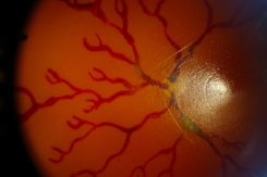 Sample Retinal 1 small